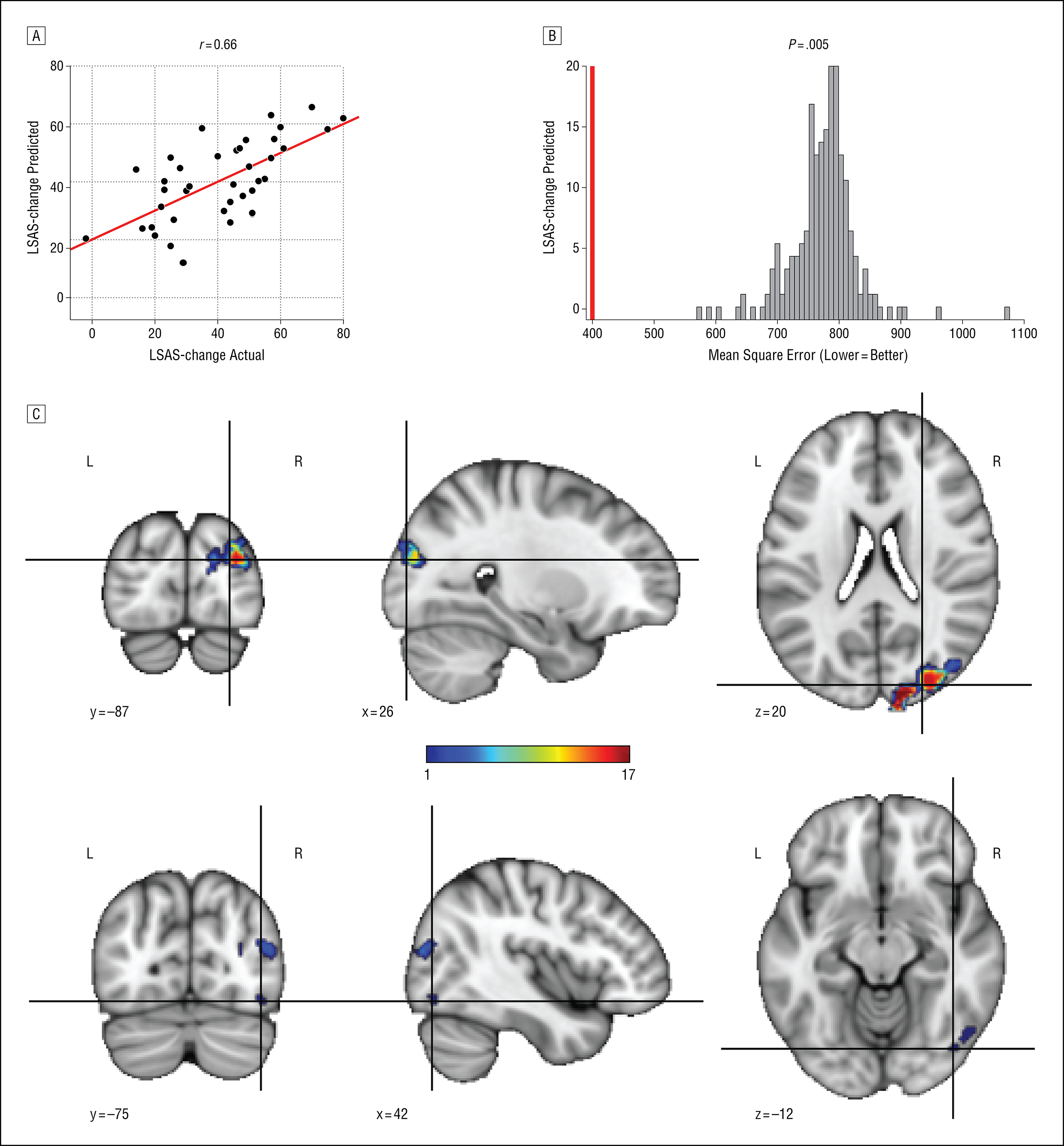 Figure from a JAMA Psychiatry paper on predicting treatment outcome in social anxiety disorder