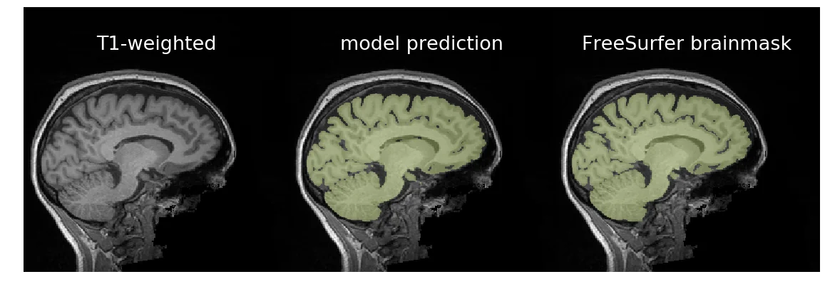 Nobrainer — Neural network tool suite for imagers