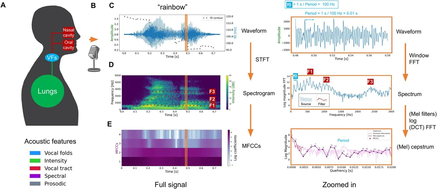 Detecting vocal-fold paralysis from voice